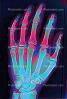 hand, fingers, X-Ray, HASV01P09_06C.2015