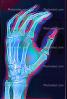 hand, fingers, X-Ray, HASV01P09_06D.2015