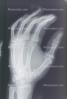 hand, fingers, X-Ray, HASV01P09_07