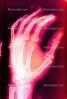 hand, fingers, X-Ray, HASV01P09_07D