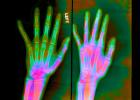 hand, fingers, X-Ray, HASV01P09_08B.2015