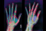 hand, fingers, X-Ray, HASV01P09_09B.2015