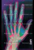 hand, fingers, X-Ray, HASV01P09_09C.2015