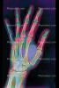 hand, fingers, X-Ray, HASV01P09_09D.2015