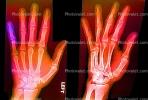 hand, fingers, X-Ray, HASV01P09_11B