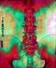 pelvis, back, vertebrae, spine, X-Ray, HASV01P09_15B.2014