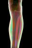 leg, knee, X-Ray, HASV01P10_10