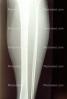 leg, X-Ray, HASV01P10_16
