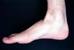 Foot, Toes, Joints, Ankle, Heal, Skin, Epidermis