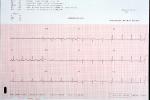 Heart and Pulse rate chart, ECG, Electrocardiogram, Electric Rhythms, HDEV01P03_01