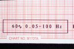 Heart and Pulse rate chart, ECG