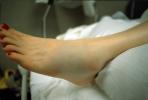 swollen foot, fracture, HEPV03P07_08