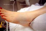 swollen foot, fracture, HEPV03P07_08