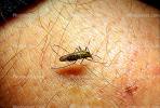 Mosquito, BIG and BAD and Thirsty, Human Skin Texture, Hair, Alaska, OEFV01P12_10.0145