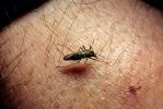 Big Bad Mosquito, Thirsty, Human Skin Texture, Hair, Alaska, OEFV01P12_10