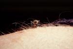Mosquito, BIG and BAD and Thirsty, Human Skin Texture, Hair, Alaska, OEFV01P12_11