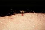 Mosquito, BIG and BAD and Thirsty, Human Skin Texture, Hair, Alaska, OEFV01P12_12