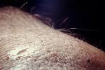Mosquito, BIG and BAD and Thirsty, Human Skin Texture, Hair, Alaska, OEFV01P12_16