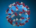 Measles Virus, Virions, tuberculars, OUVD01_007