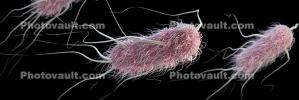 ESBL, Escherichia coli bacteria, E-coli