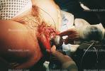 Woman giving Birth, Childbirth
