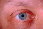 Eyes, Eyelash, skin, Eyeball, Iris, Lens, Pupil, Cornea, Sclera, Man, Male, PACV02P02_04.2677