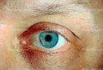 Eyes, Eyelash, skin, Eyeball, Iris, Lens, Pupil, Cornea, Sclera, Man, Male, PACV02P02_04B