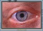 Eyes, Eyelash, skin, Eyeball, Iris, Lens, Pupil, Cornea, Sclera, Man, Male, PACV02P02_05