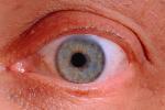 Eyes, Eyelash, skin, Eyeball, Iris, Lens, Pupil, Cornea, Sclera, Man, Male, PACV02P02_06.2677