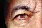 Eyeball, Iris, Lens, Pupil, Eyelash, Cornea, Sclera, Man, Male, skin, Eye Brow, Eyebrow