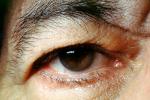 Eyeball, Iris, Lens, Pupil, Eyelash, Cornea, Sclera, Man, Male, skin, Eye Brow, Eyebrow, PACV02P10_08