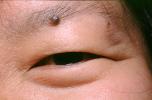 Eyeball, Iris, Lens, Pupil, Asian, Cornea, Sclera, Man, Male, skin, Eye Brow, Eyebrow, PACV02P10_11