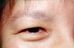 Eyeball, Iris, Lens, Pupil, Asian, Cornea, Sclera, Man, Male, skin, Eye Brow, Eyebrow, PACV02P10_12