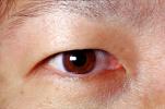 Eyeball, Iris, Lens, Pupil, Cornea, Sclera, Man, Male, skin, Eye Brow, Eyebrow, PACV02P10_15