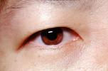 Eyeball, Iris, Lens, Pupil, Cornea, Sclera, Man, Male, skin, Eye Brow, Eyebrow