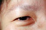 Eyeball, Iris, Lens, Pupil, Cornea, Sclera, Man, Male, skin, Eye Brow, Eyebrow, PACV02P10_17