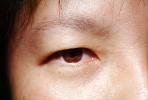 Eyeball, Iris, Lens, Pupil, Cornea, Sclera, Man, Male, skin, Eye Brow, Eyebrow, PACV02P10_18