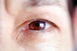 Eyeball, Iris, Lens, Pupil, Cornea, Sclera, Man, Male, skin, Eye Brow, Eyebrow, Eyelash