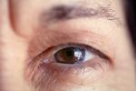 Eyeball, Iris, Lens, Pupil, Cornea, Sclera, Man, Male, skin, Eye Brow, Eyebrow, Eyelash, PACV02P11_01