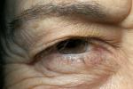 Eyeball, Iris, Lens, Pupil, Cornea, Sclera, Woma, Female, Eye Brow, Eyebrow, Eyelash, skin, PACV02P11_04B