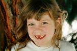 Girl, smiles, face, missing-teeth, PLPV11P05_10