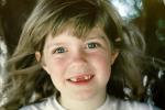 Girl, smiles, face, missing-teeth, PLPV11P05_14