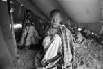 Leprosy, Refugee Camp, near the Ethiopia Somalia border, African Diaspora, Somalia, POV35V07P43_03