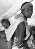Tuberculosis, Refugee Camp, near the Ethiopia Somalia border, African Diaspora, Somalia, POV35V07P43_16B
