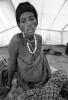 Tuberculosis, Refugee Camp, near the Ethiopia Somalia border, African Diaspora, Somalia, POV35V07P43_20