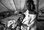 Tuberculosis, Refugee Camp, near the Ethiopia Somalia border, African Diaspora, Somalia, POV35V07P44_14