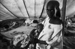 Tuberculosis, Refugee Camp, near the Ethiopia Somalia border, African Diaspora, Somalia, POV35V07P44_15
