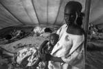 Tuberculosis, Refugee Camp, near the Ethiopia Somalia border, African Diaspora, Somalia, POV35V07P44_16