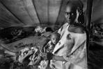 Tuberculosis, Refugee Camp, near the Ethiopia Somalia border, African Diaspora, Somalia, POV35V07P44_17