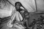 Tuberculosis, Refugee Camp, near the Ethiopia Somalia border, African Diaspora, Somalia, POV35V07P44_19